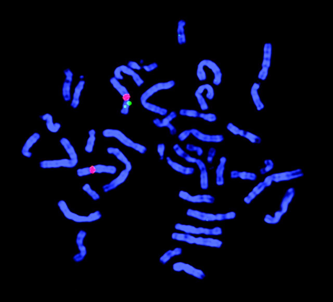 Chromosomenpräparat unter dem Fluoreszenzmikroskop