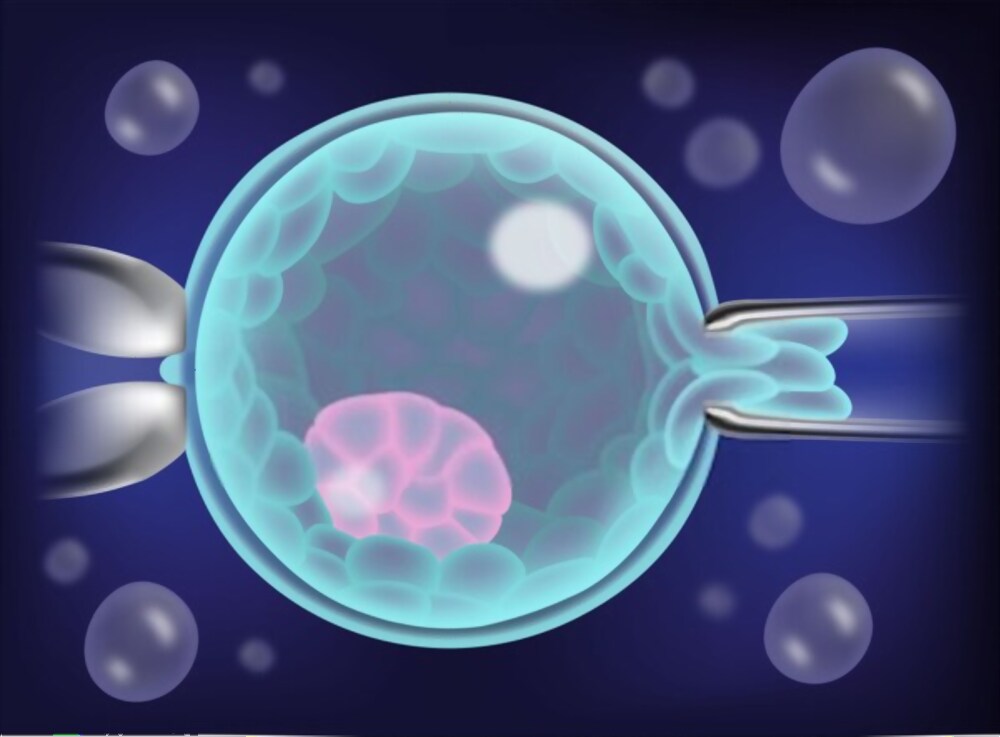 Embryo-Abbildung zur Veranschaulichung des Ablaufs der Präimplantationsdiagnostik