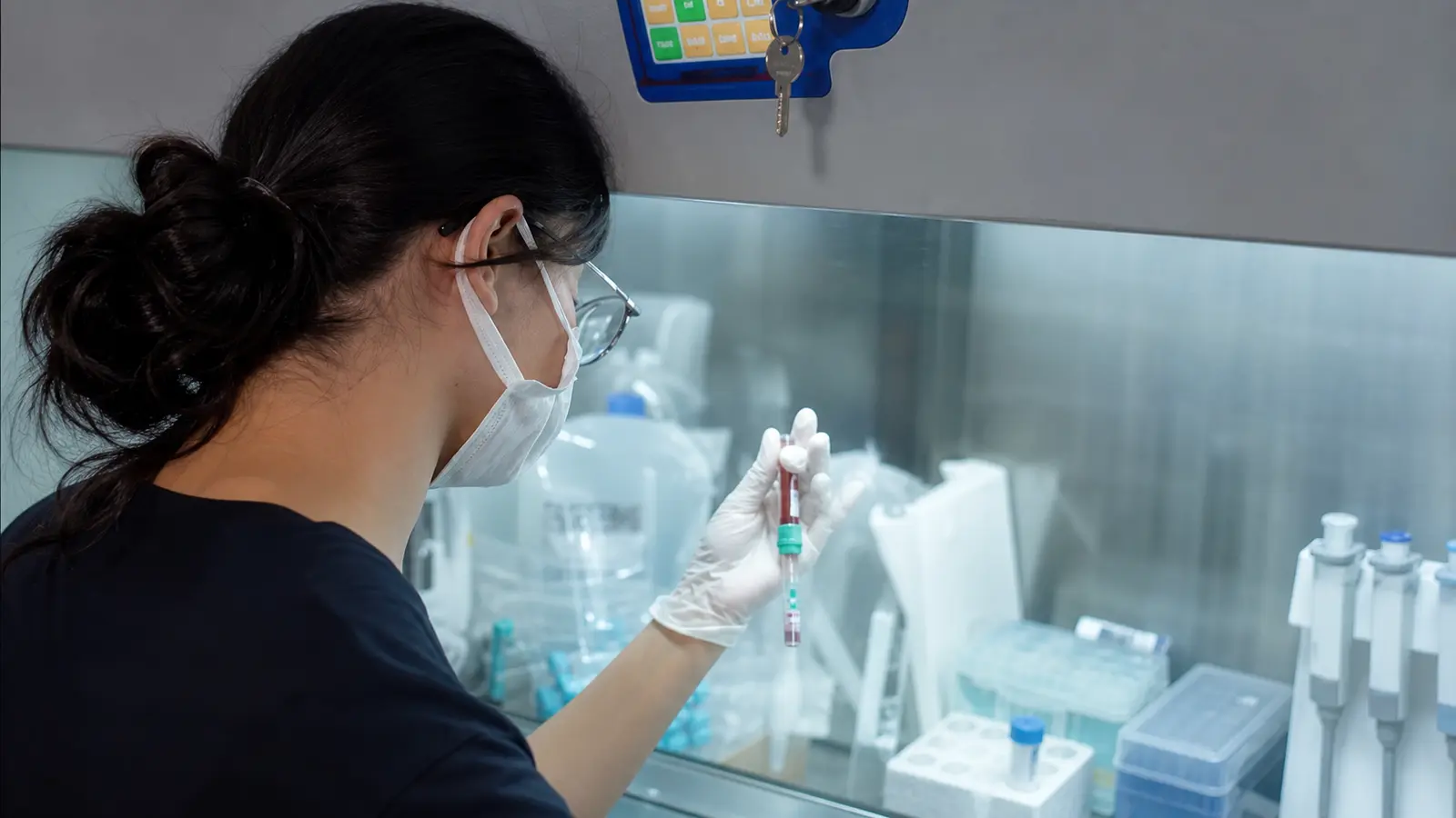 Sitogenetik Laboratuvarımızda Hücre Kültürü ve Kromozom Analizi Süreçleri