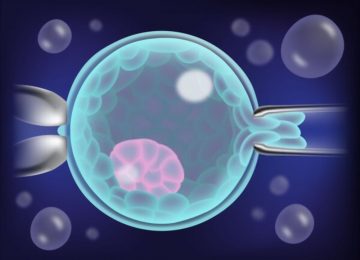 Preimplantasyon Genetik Tanı Preimplantasyon Genetik Tanı